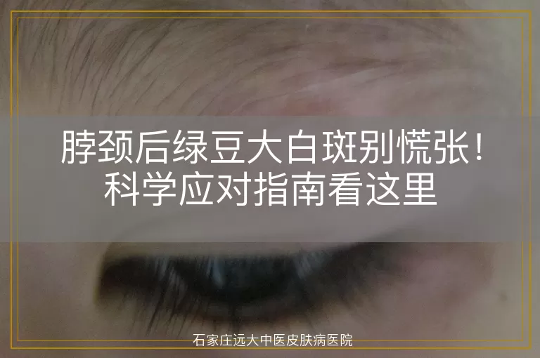脖颈后绿豆大白斑别慌张！科学应对指南看这里