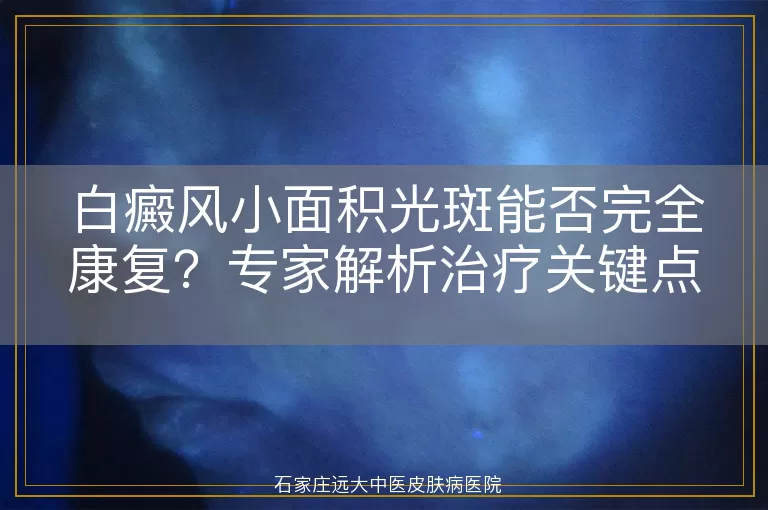 白癜风小面积光斑能否完全康复？专家解析治疗关键点