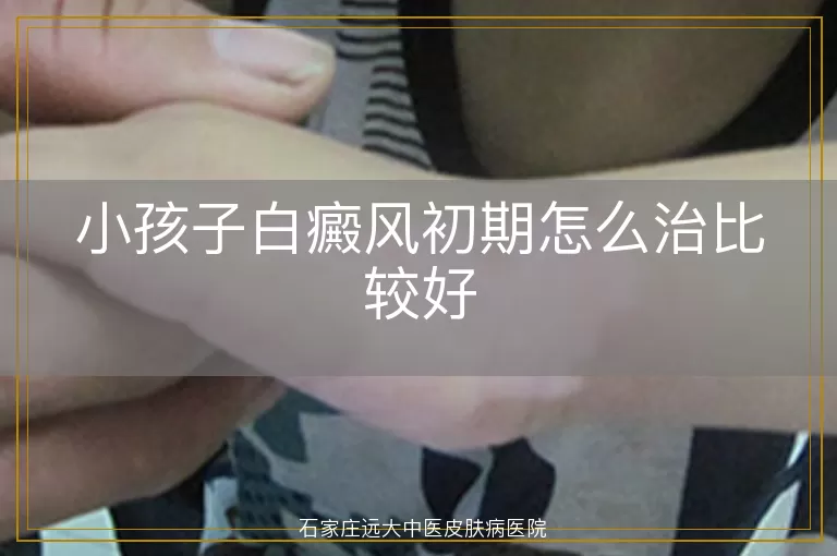 小孩子白癜风初期怎么治比较好