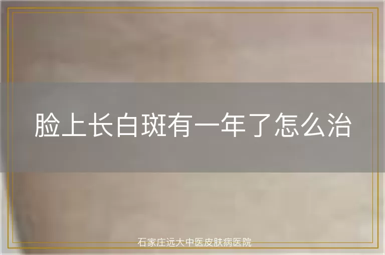 脸上长白斑有一年了怎么治