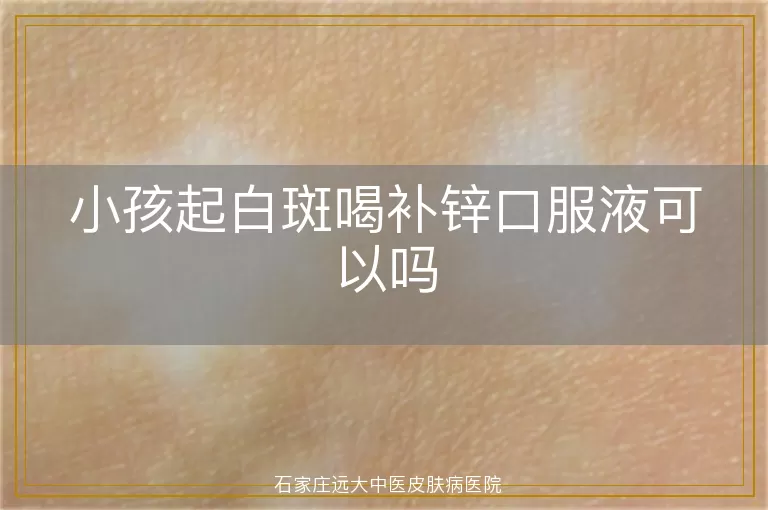 小孩起白斑喝补锌口服液可以吗