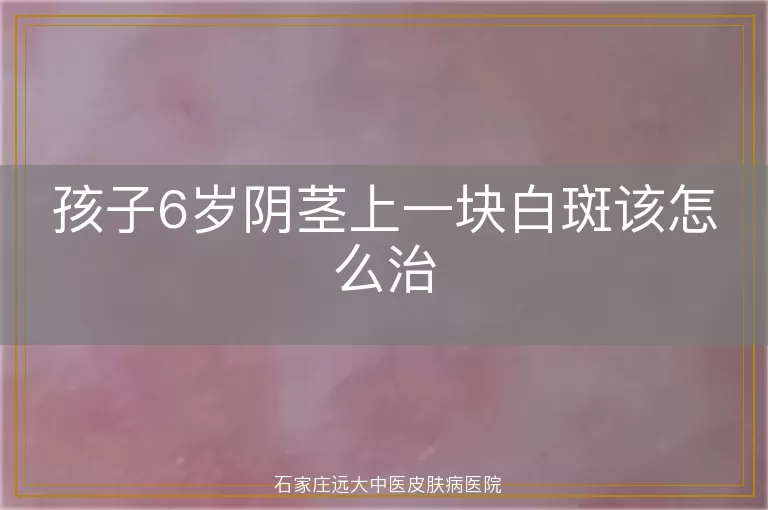 孩子6岁阴茎上一块白斑该怎么治