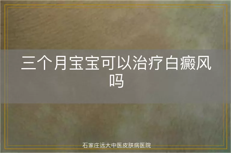 三个月宝宝可以治疗白癜风吗
