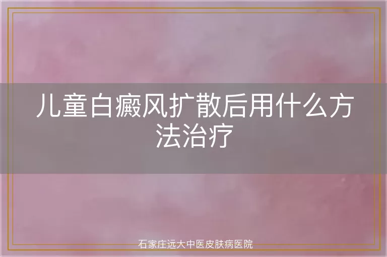 儿童白癜风扩散后用什么方法治疗