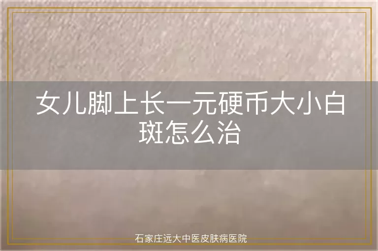女儿脚上长一元硬币大小白斑怎么治
