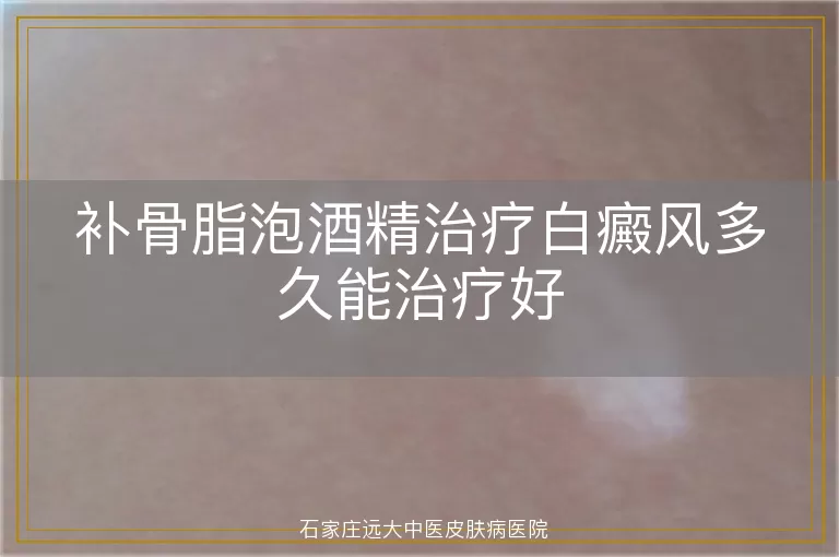补骨脂泡酒精治疗白癜风多久能治疗好