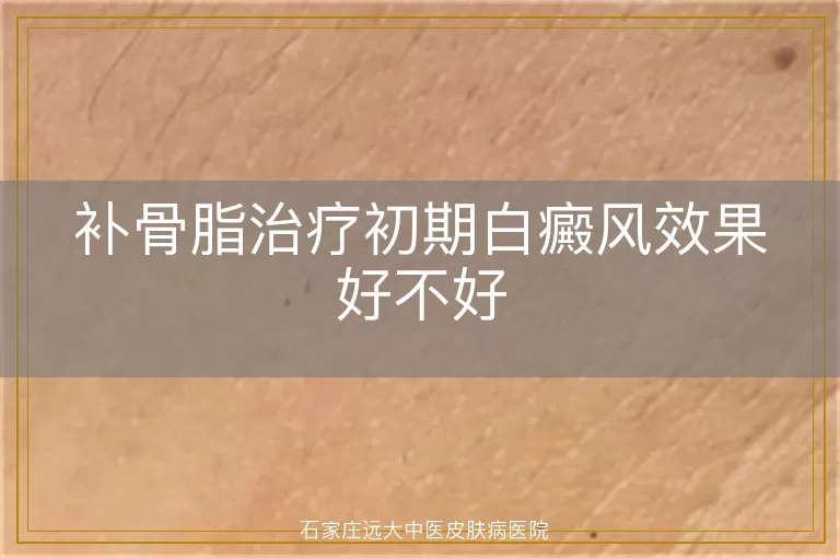补骨脂治疗初期白癜风效果好不好