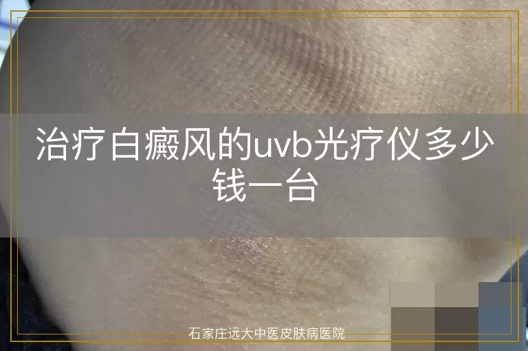 治疗白癜风的uvb光疗仪多少钱一台