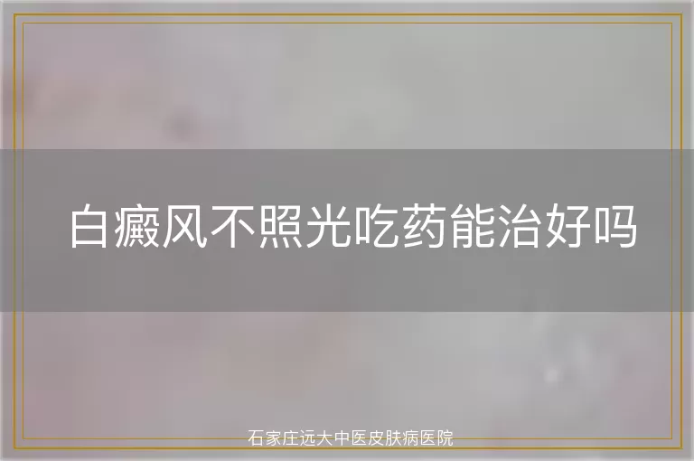 白癜风不照光吃药能治好吗