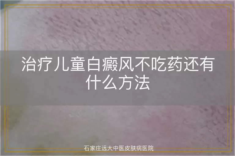 治疗儿童白癜风不吃药还有什么方法
