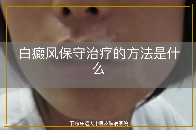 白癜风保守治疗的方法是什么