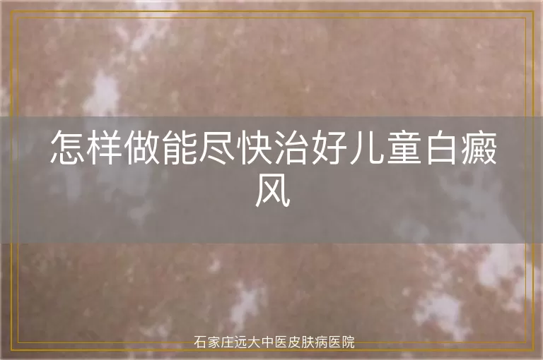 怎样做能尽快治好儿童白癜风