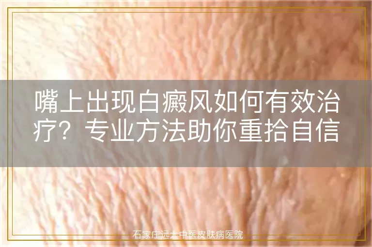 嘴上出现白癜风如何有效治疗？专业方法助你重拾自信