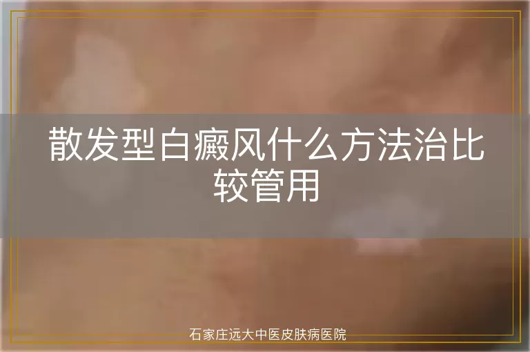 散发型白癜风什么方法治比较管用