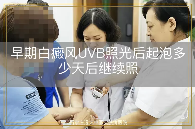早期白癜风UVB照光后起泡多少天后继续照