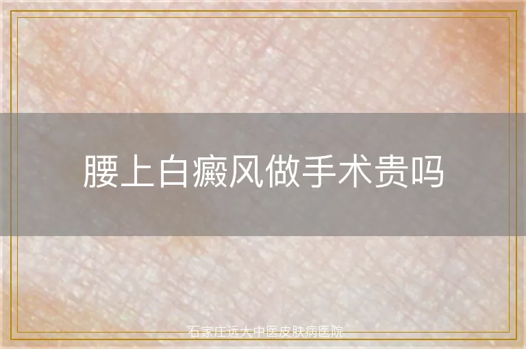 腰上白癜风做手术贵吗