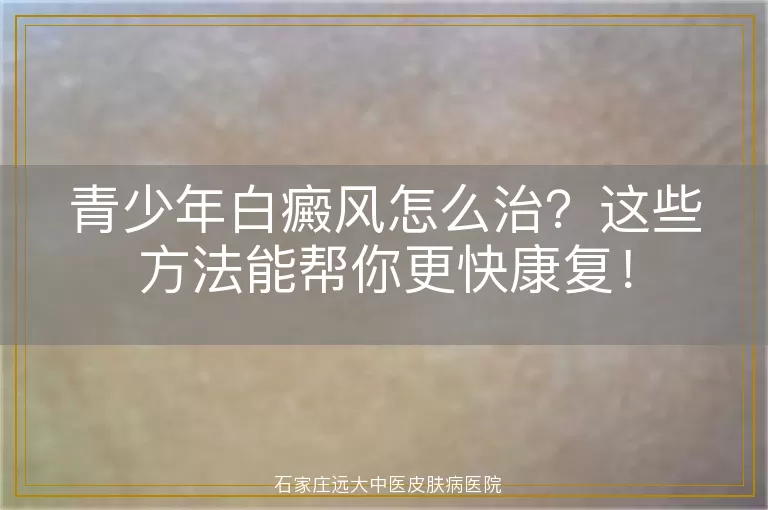 青少年白癜风怎么治？这些方法能帮你更快康复！