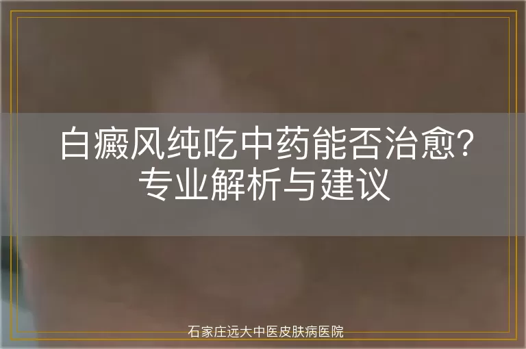 白癜风纯吃中药能否治愈？专业解析与建议