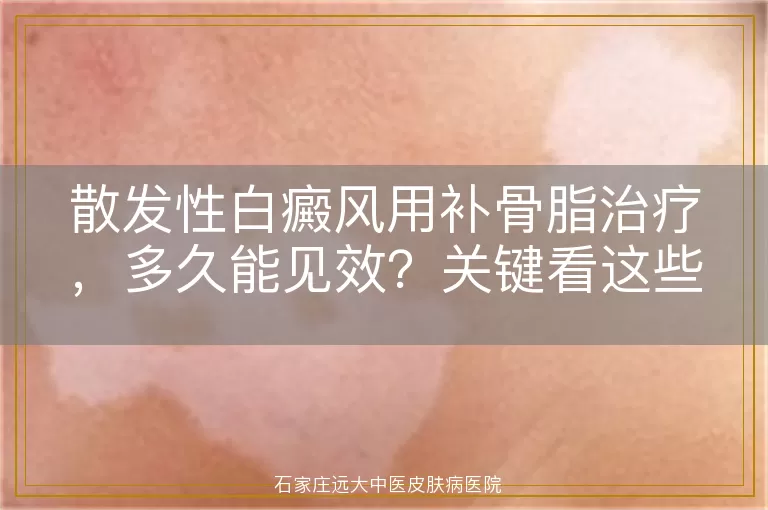 散发性白癜风用补骨脂治疗，多久能见效？关键看这些！