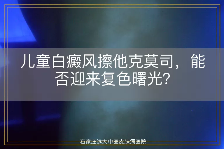 儿童白癜风擦他克莫司，能否迎来复色曙光？