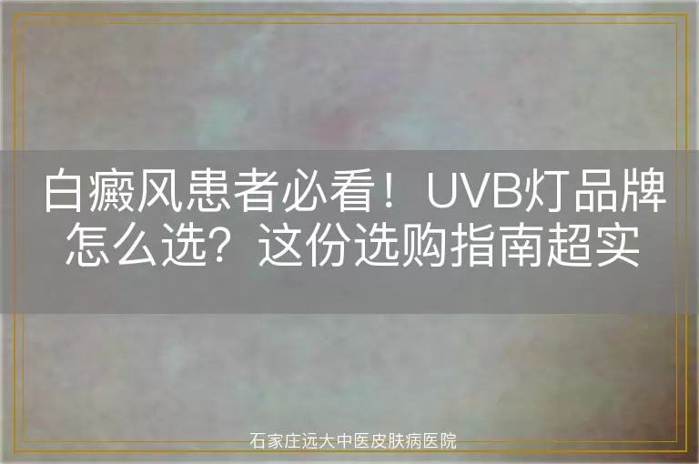 白癜风患者必看！UVB灯品牌怎么选？这份选购指南超实用