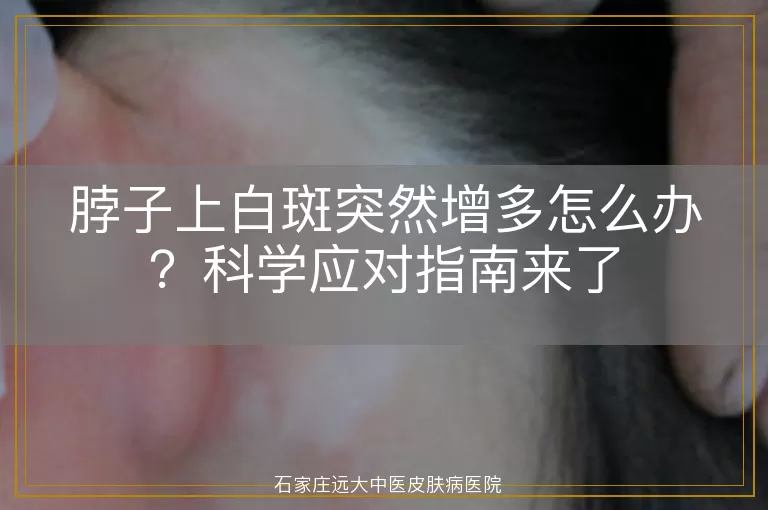 脖子上白斑突然增多怎么办？科学应对指南来了