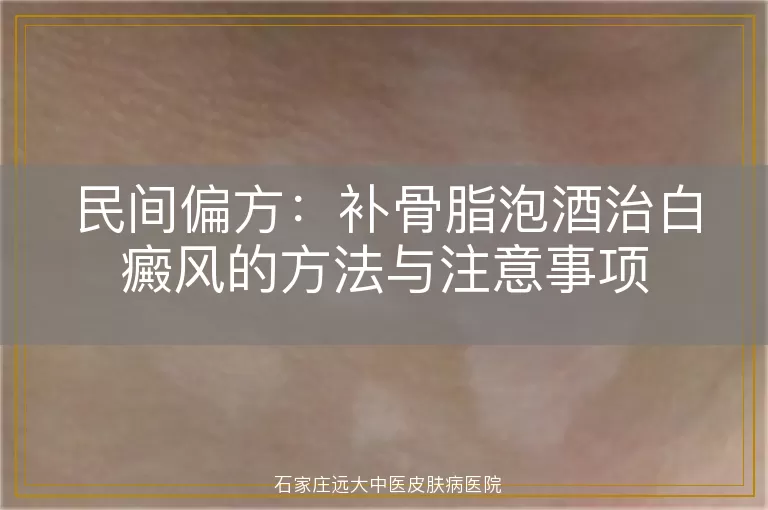 民间偏方：补骨脂泡酒治白癜风的方法与注意事项