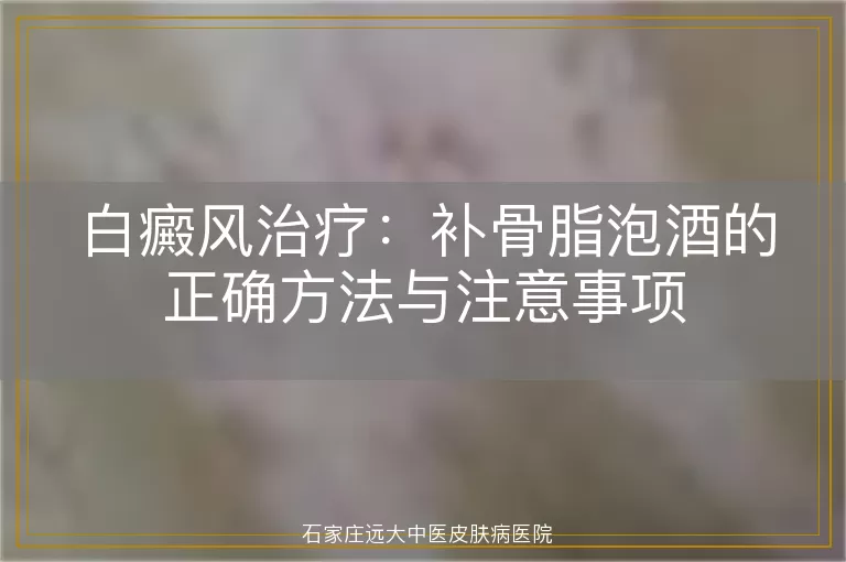 白癜风治疗：补骨脂泡酒的正确方法与注意事项
