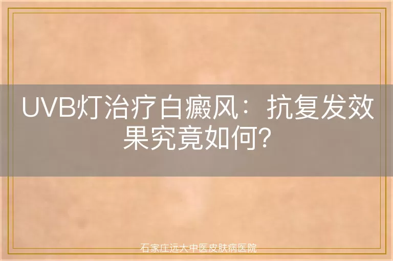 UVB灯治疗白癜风：抗复发效果究竟如何？