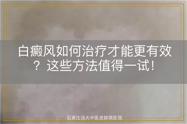 白癜风如何治疗才能更有效？这些方法值得一试！