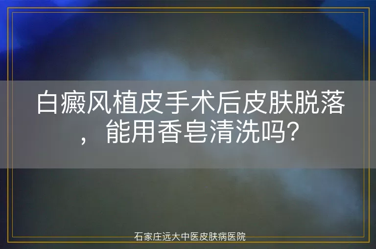 白癜风植皮手术后皮肤脱落，能用香皂清洗吗？