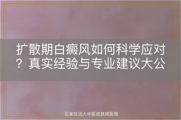 扩散期白癜风如何科学应对？真实经验与专业建议大公开