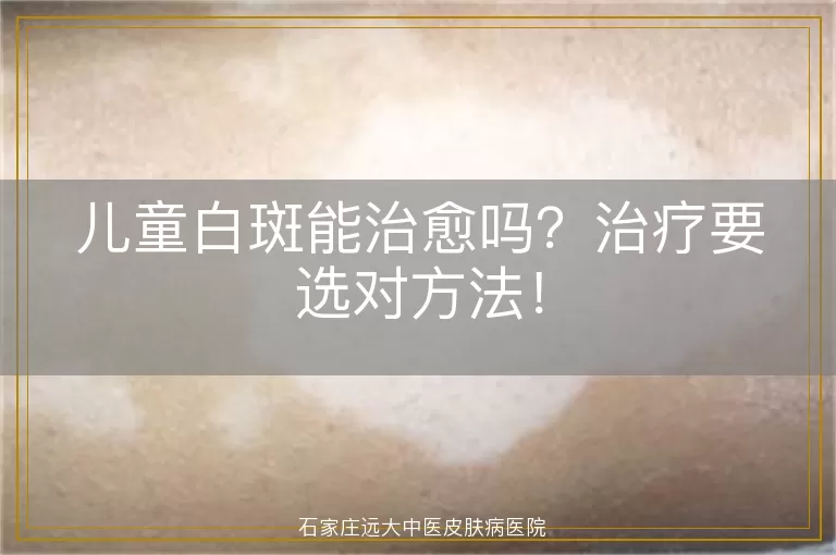 儿童白斑能治愈吗？治疗要选对方法！