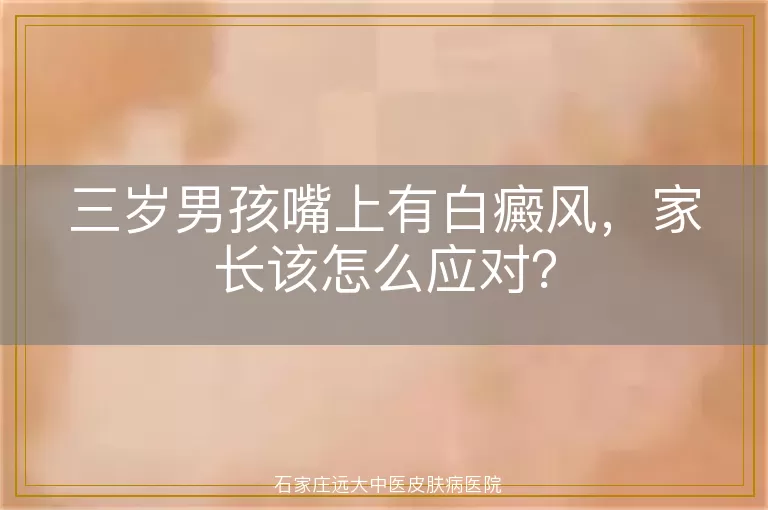 三岁男孩嘴上有白癜风，家长该怎么应对？