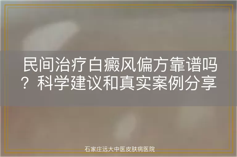 民间治疗白癜风偏方靠谱吗？科学建议和真实案例分享