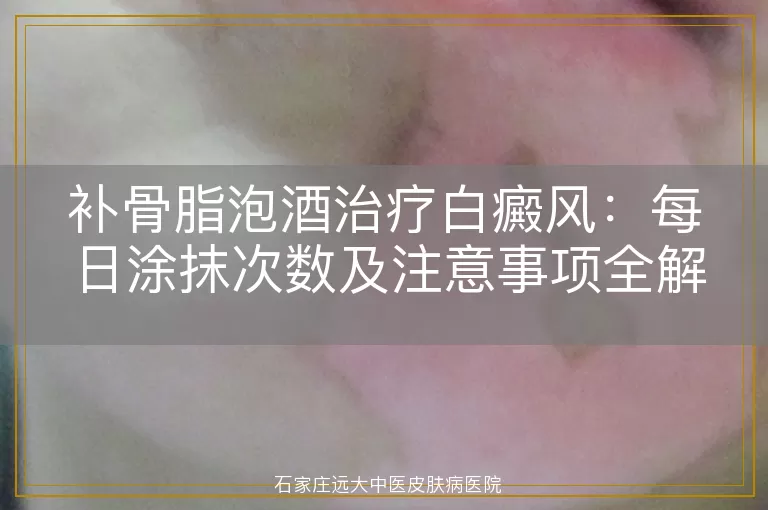 补骨脂泡酒治疗白癜风：每日涂抹次数及注意事项全解析