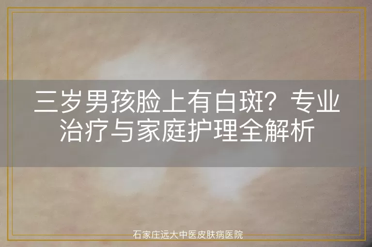 三岁男孩脸上有白斑？专业治疗与家庭护理全解析
