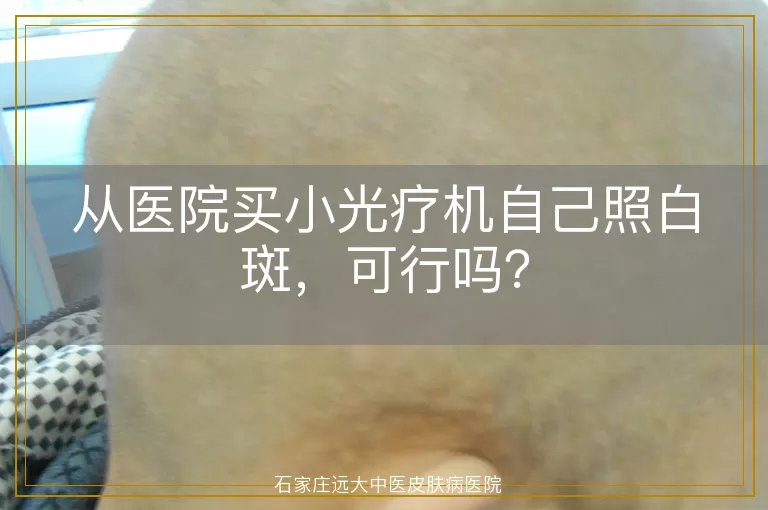 从医院买小光疗机自己照白斑，可行吗？