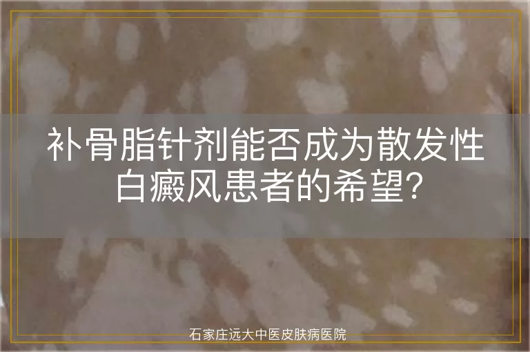 补骨脂针剂能否成为散发性白癜风患者的希望？