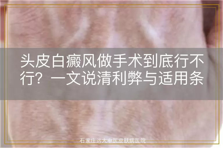 头皮白癜风做手术到底行不行？一文说清利弊与适用条件