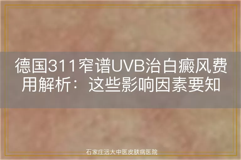 德国311窄谱UVB治白癜风费用解析：这些影响因素要知道