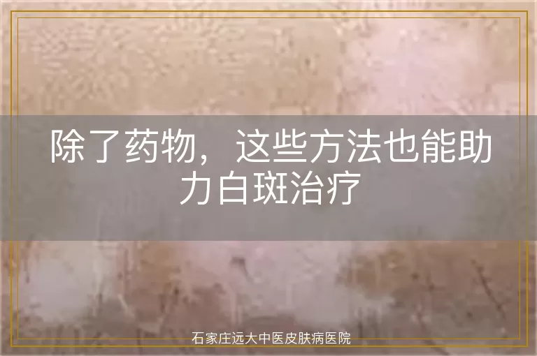 除了药物，这些方法也能助力白斑治疗