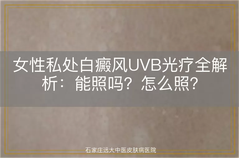 女性私处白癜风UVB光疗全解析：能照吗？怎么照？