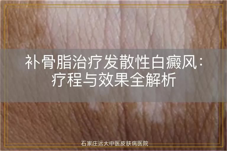 补骨脂治疗发散性白癜风：疗程与效果全解析