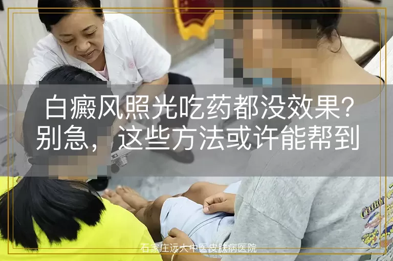白癜风照光吃药都没效果？别急，这些方法或许能帮到你！