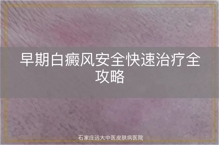 早期白癜风安全快速治疗全攻略