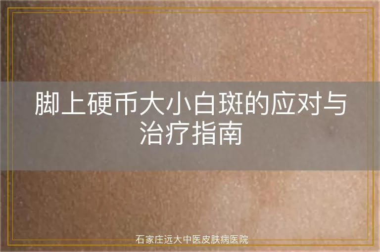 脚上硬币大小白斑的应对与治疗指南