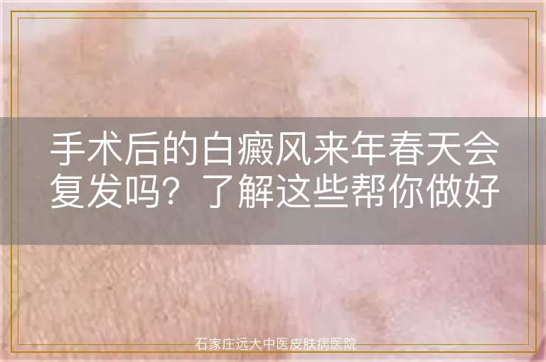 手术后的白癜风来年春天会复发吗？了解这些帮你做好预防
