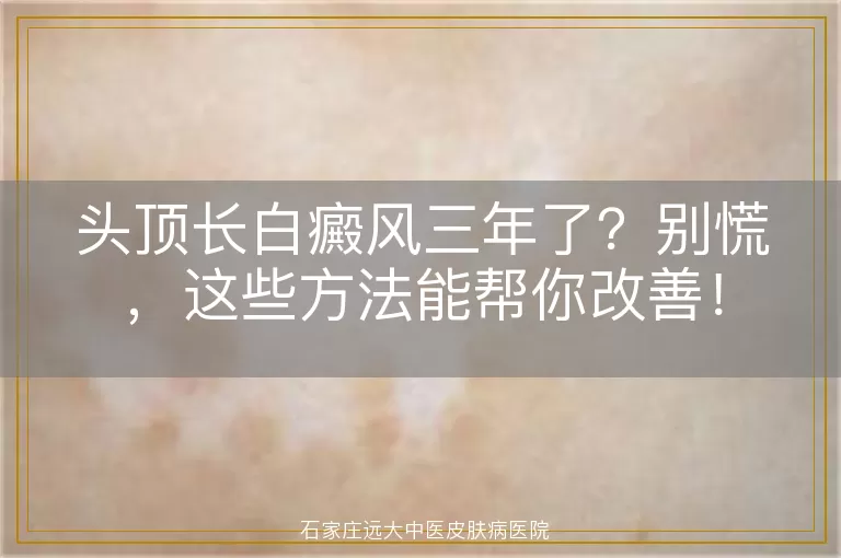 头顶长白癜风三年了？别慌，这些方法能帮你改善！