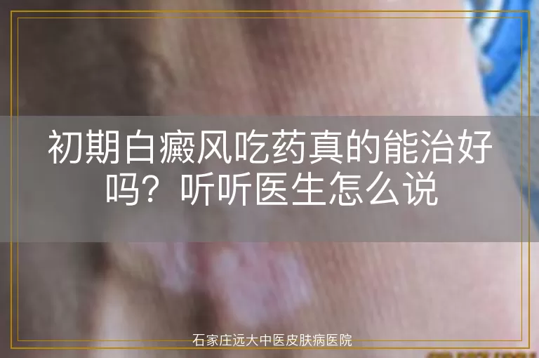 初期白癜风吃药真的能治好吗？听听医生怎么说